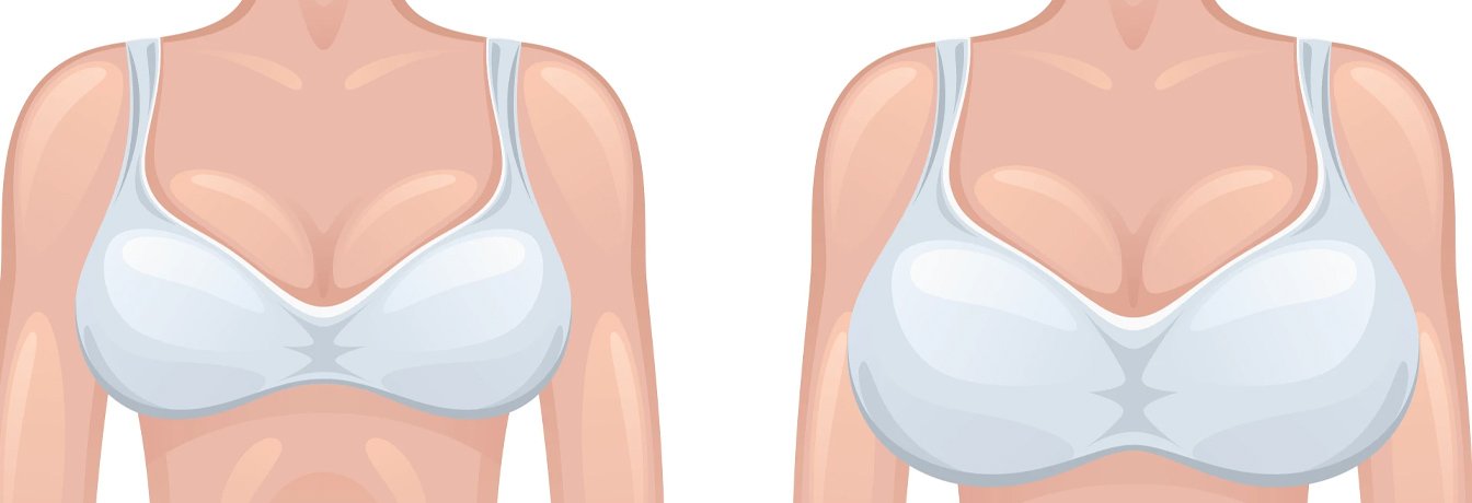 breast growth
